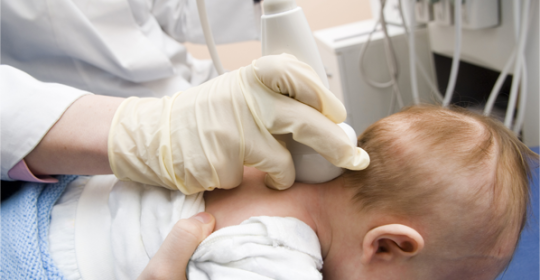 USG mózgu u niemowląt badaniem koniecznym w sytuacjach niedotlenienia płodu w czasie ciąży